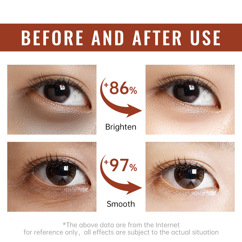 Retinol Firming Eye Cream Anti - огляд і ціна Women Bags Under Eyes